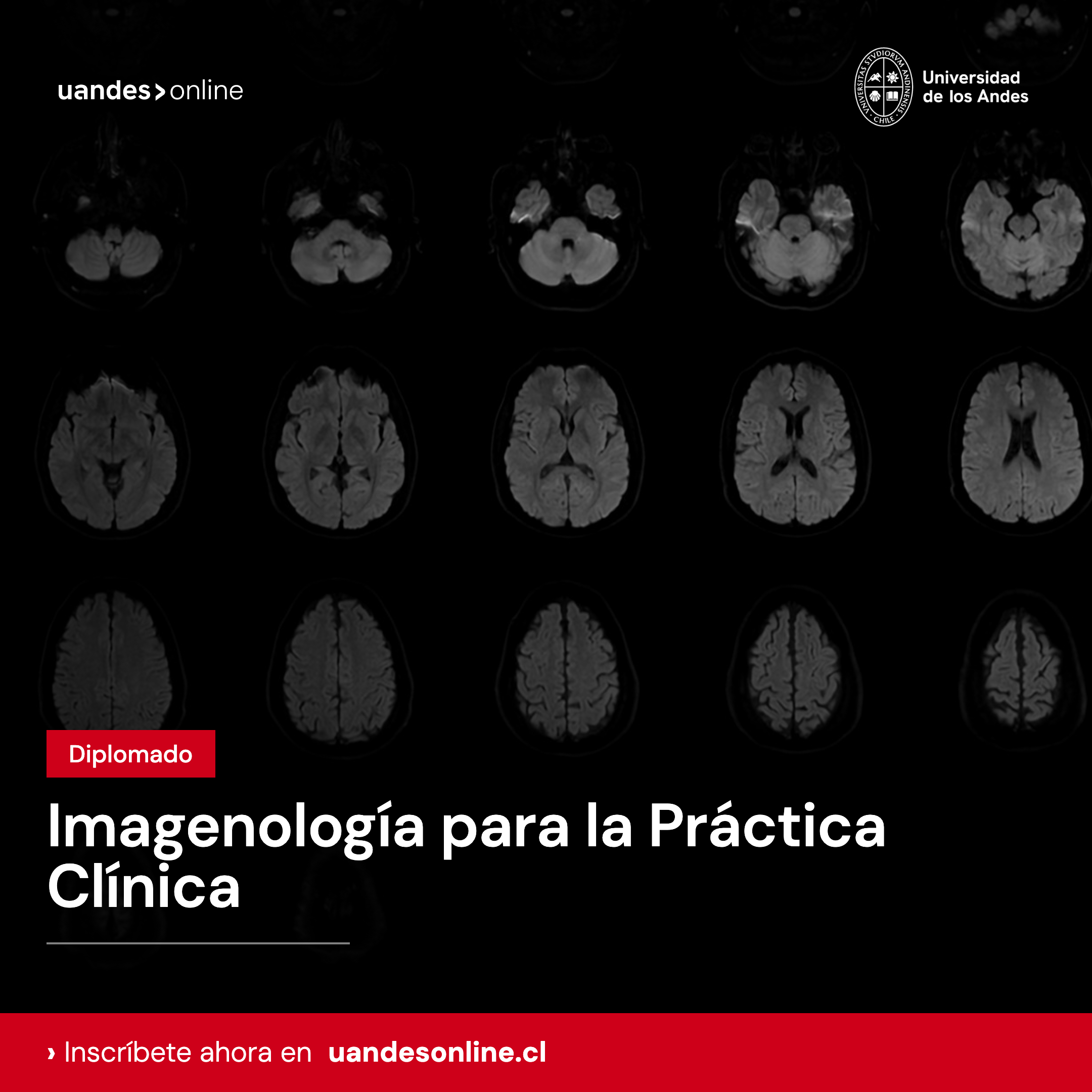 Diplomado en Imagenología para la Práctica Clínica