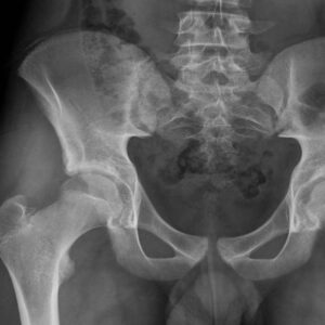 Curso Imagenología en Abdomen y Pelvis