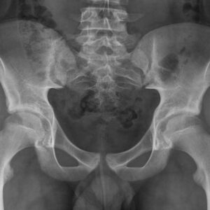 Curso Imagenología en Abdomen y Pelvis